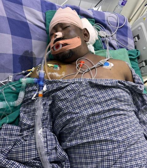 आइसीयूमा उपचाररत जेनजी आन्दोलनका गम्भीर घाइते लक्ष्मण राईको मृत्यु